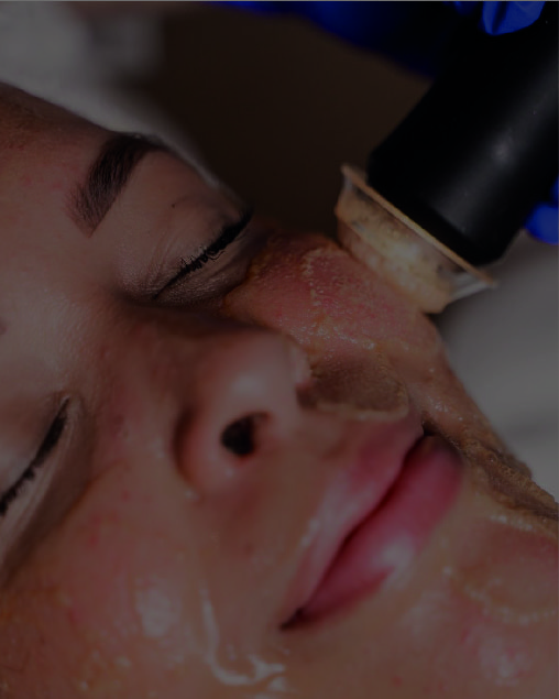 Higiene Facial Profunda - Imagen 3